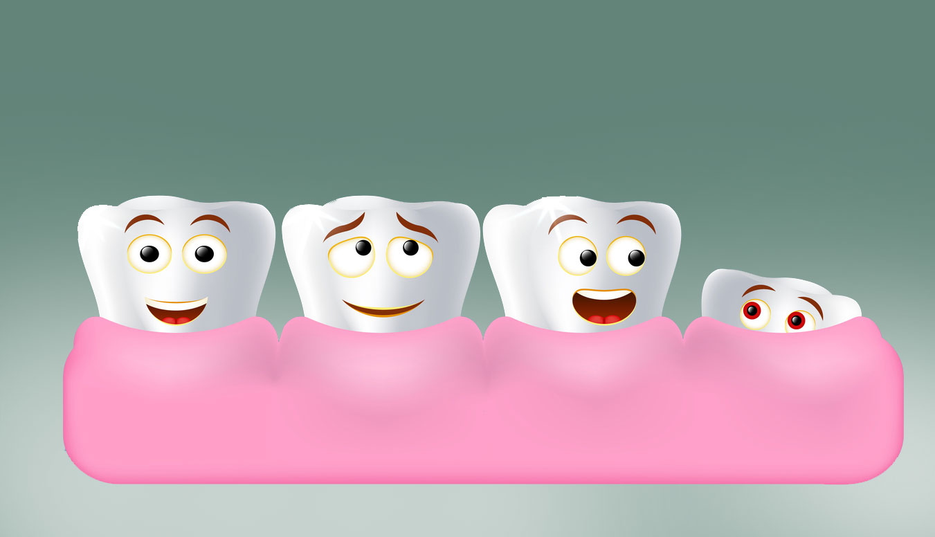 What Are the Signs of Wisdom Teeth Coming In?
