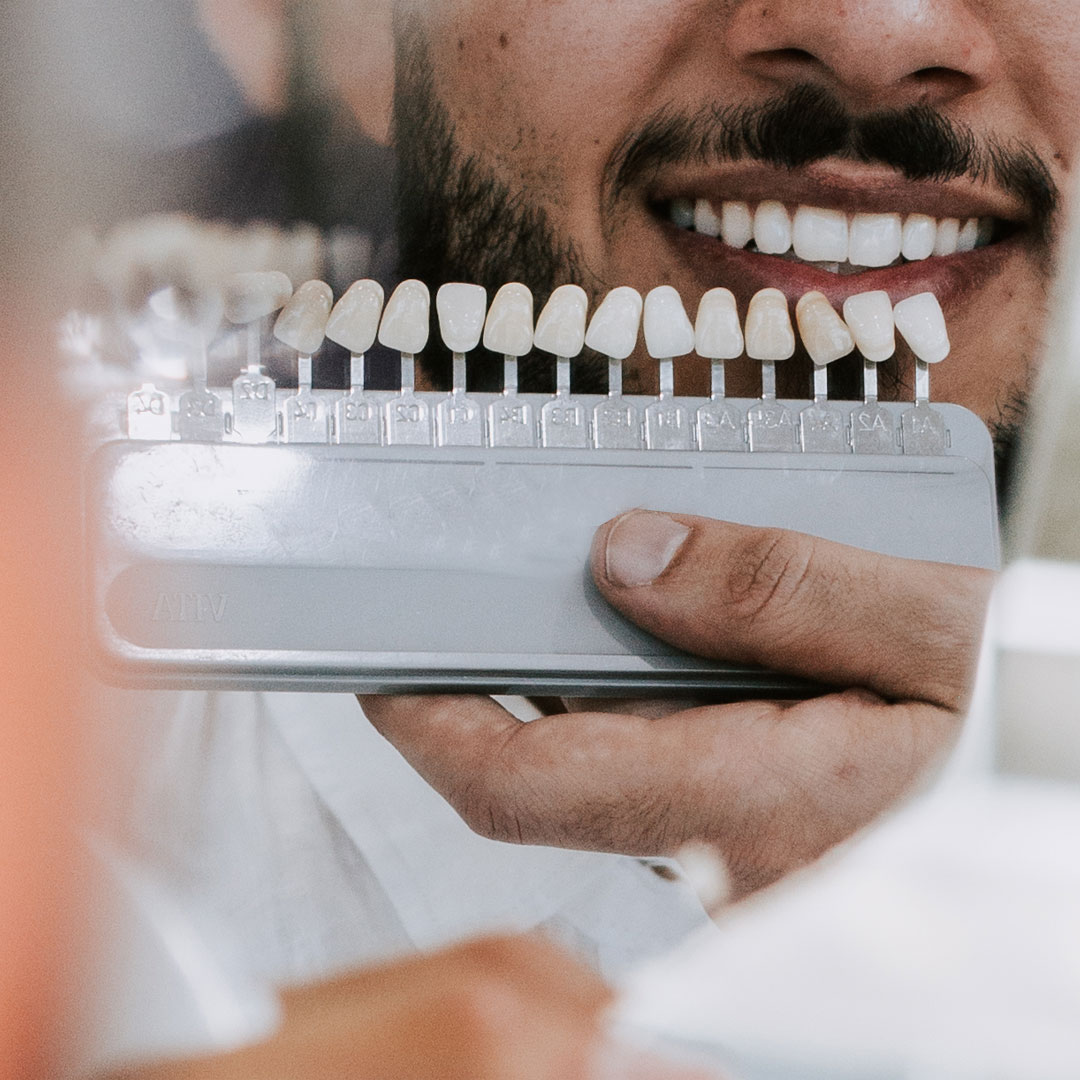 Professional Teeth Whitening Gold-Coast JJ Smiles Dental & Implant Centre