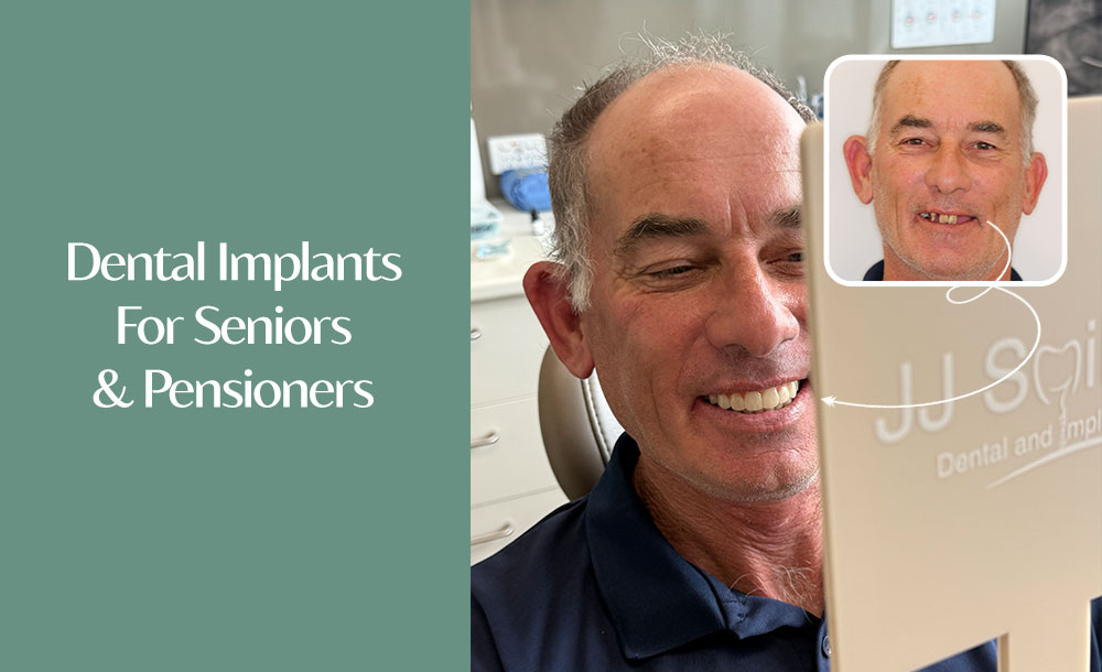 Affordable Dental Implants For Seniors and Pensioners